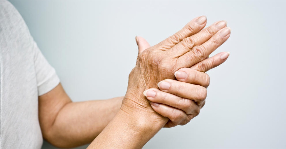 Artritis Reumatoide