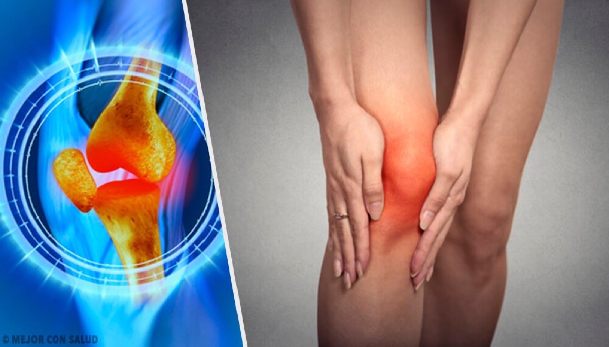 Artrosis de Rodilla