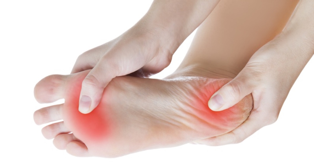 Fascitis plantar ¿Qué es? Conócela